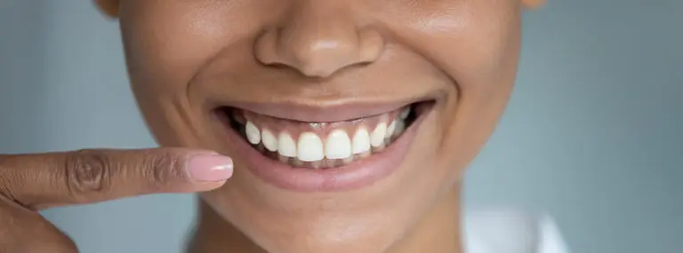 Can my teeth move after braces?