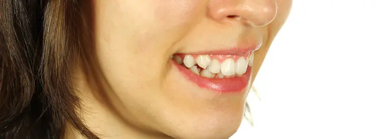 Why do humans have crooked teeth?