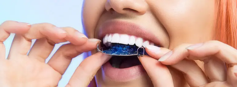 17 tips to never lose your retainer again