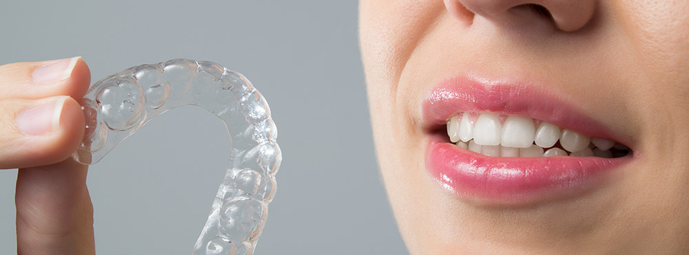 Considering Braces as An Adult? You Want to Think About Invisalign