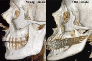 Female young versus old