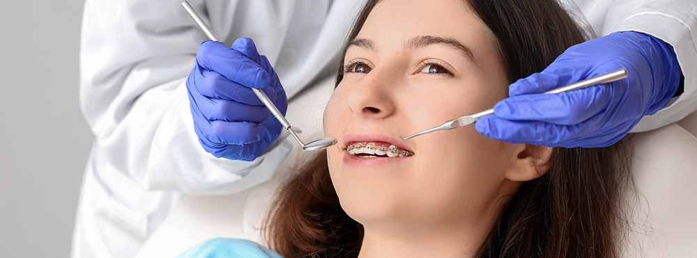 correcting an overbite