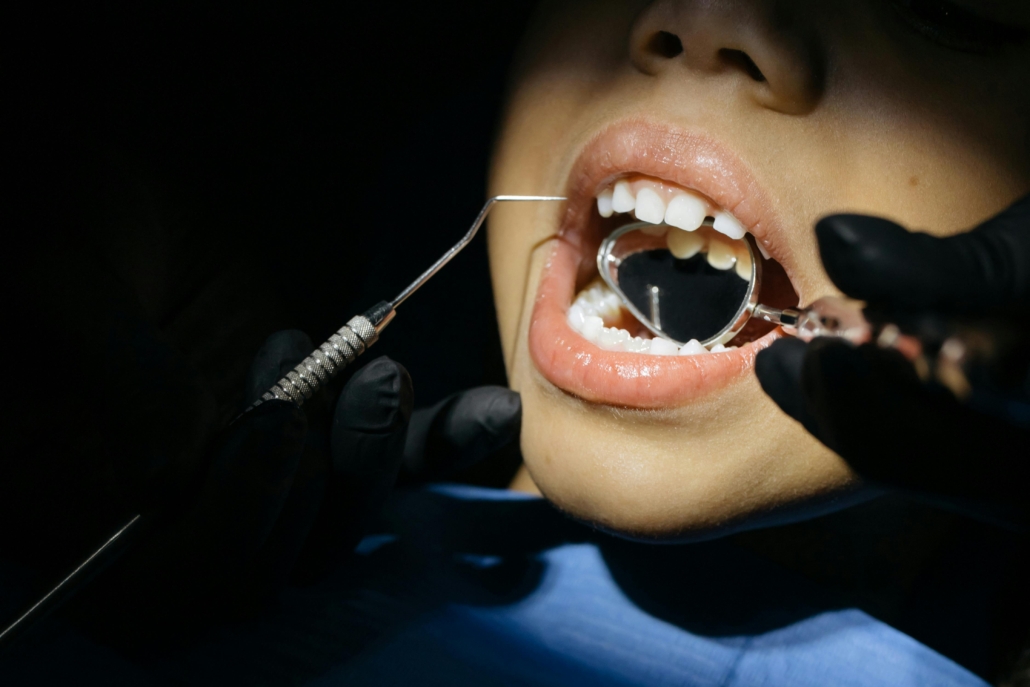 checking my teeth