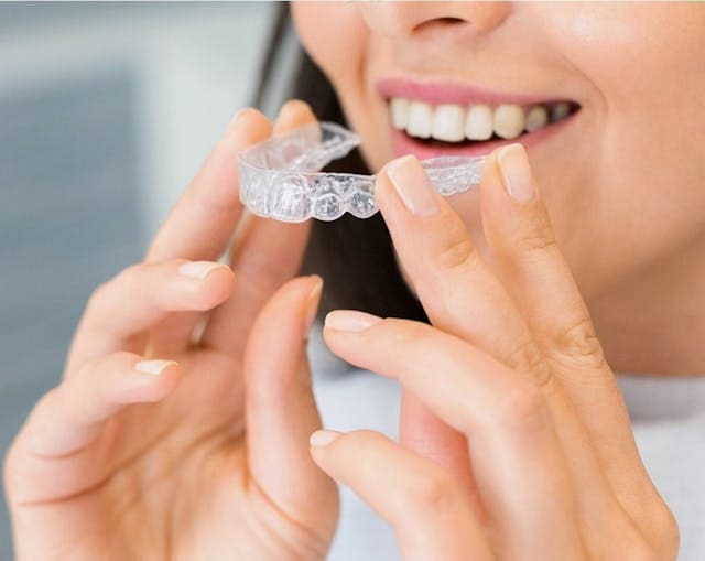 The Ultimate Guide to Invisalign® Cleaning Crystals: How to Use, Benefits, and Alternatives